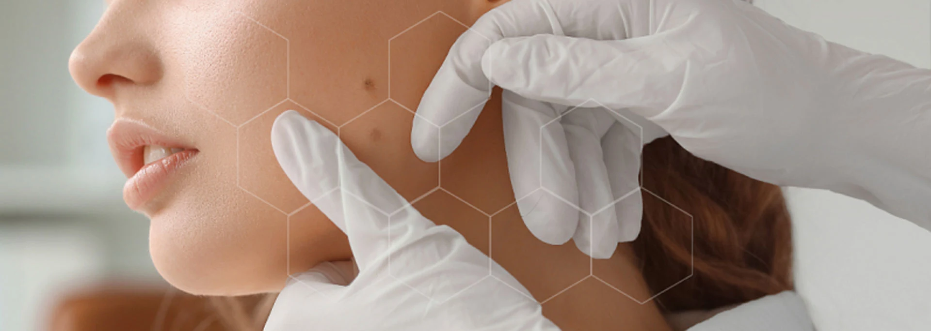 Expert dermatology skin examination at CRH ENT MRI & Diagnostics Greater Noida